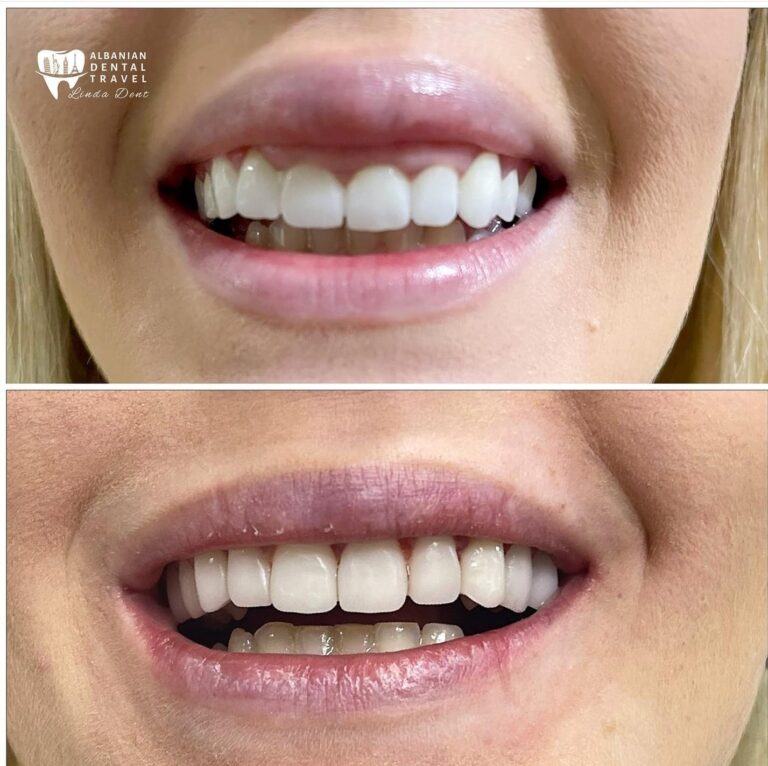 estatica dentale problemi alle gengive
