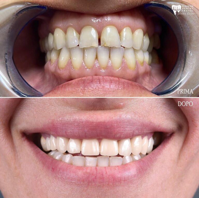 estetica dentale Albania