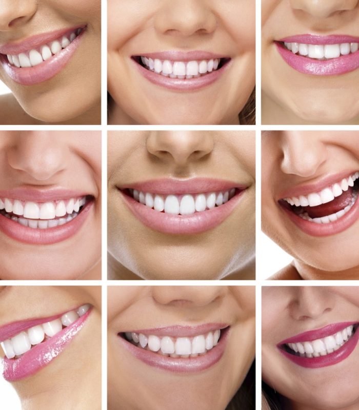multiple-smiles-1024x1024